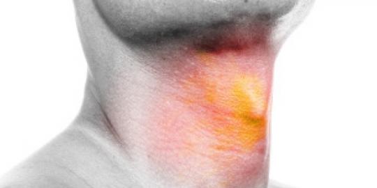 5 nguyên nhân phổ biến nhất gây ung thư họng