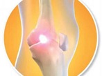 Thuốc điêu trị hội chứng đau khu vực